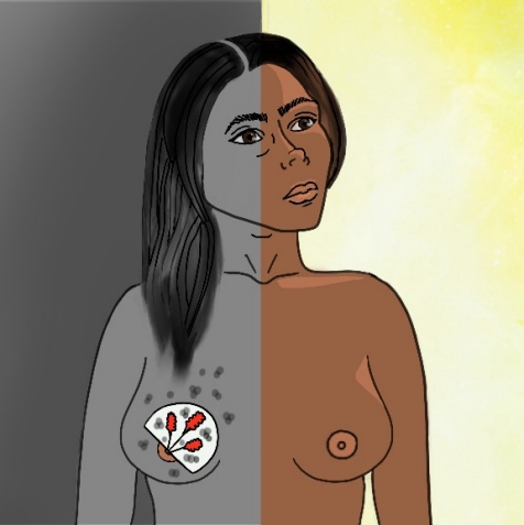 Metastatic breast cancer treatments have aided decline in deaths, Stanford Medicine-led study finds (Plevritis Lab)