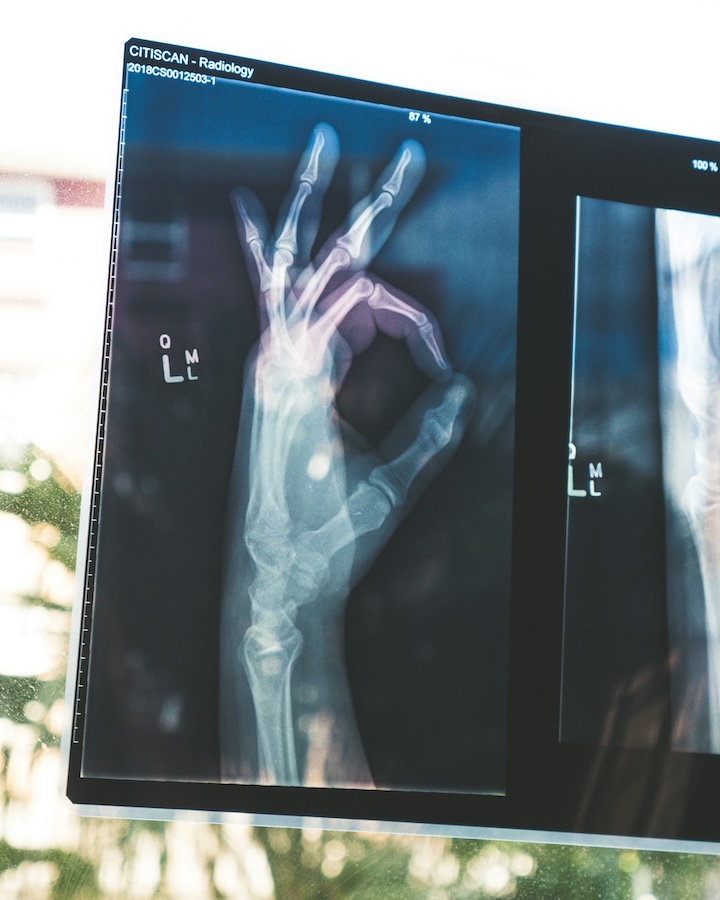 Curt Langlotz in Washington Post: AI hasn’t killed radiology, but it is changing it